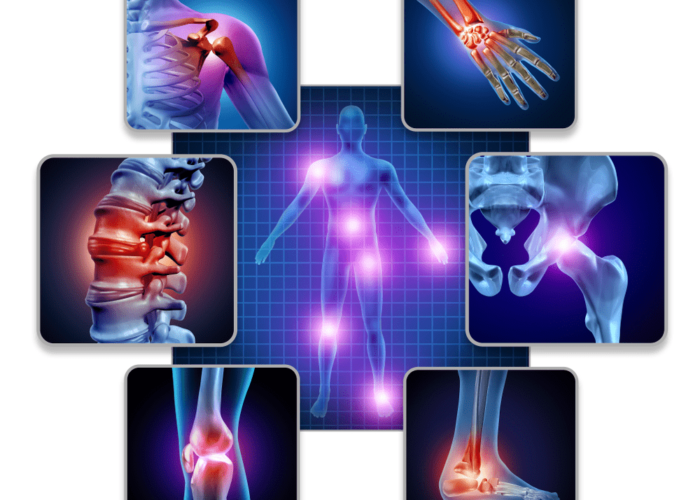 Image Joint pain